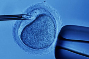 in-vitro-fertilization-22-300x197